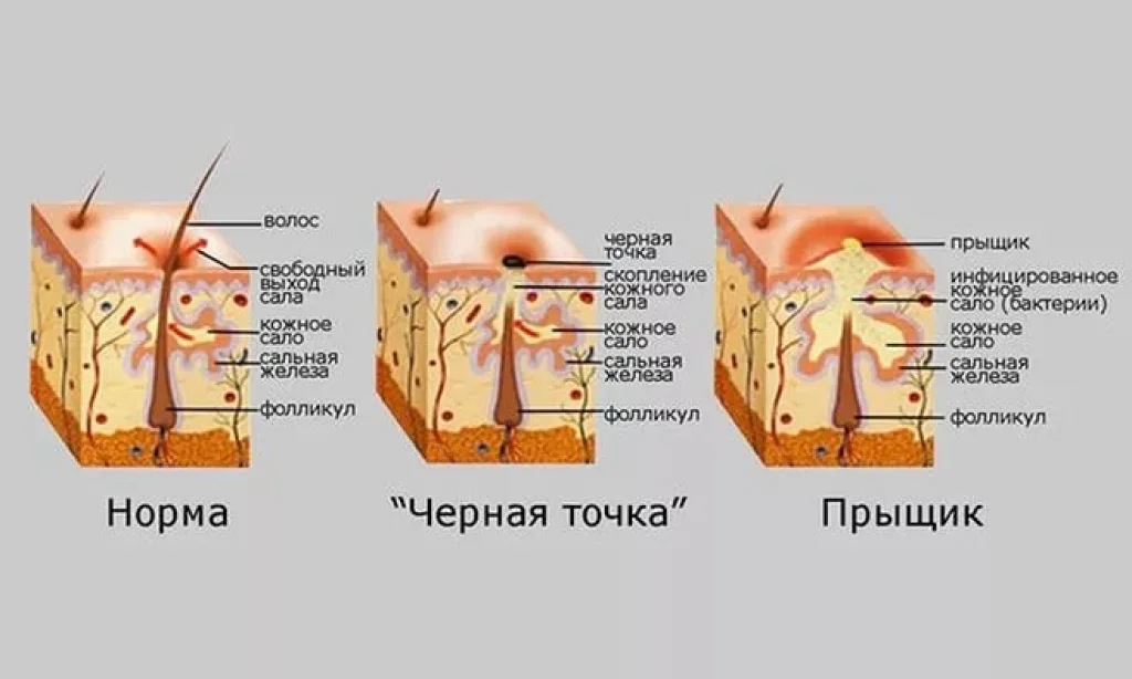 действия соды на кожу лица